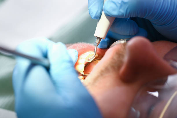Best Emergency Broken Tooth Repair in Braska City, NE
